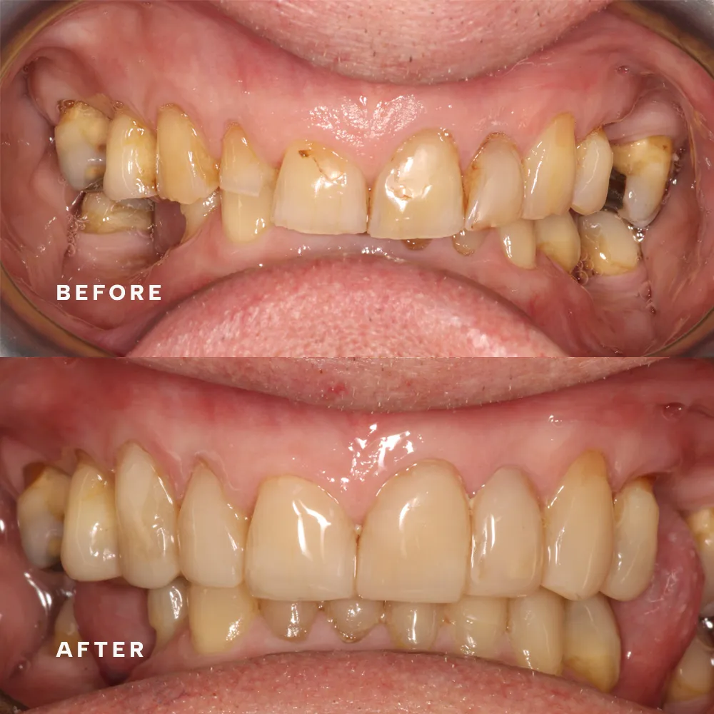 Before and after: treatment by Dr Theo Mechteridis (before above, after below)