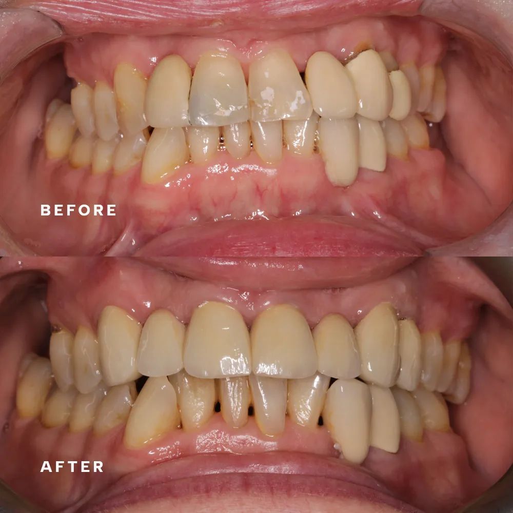 Before and after: treatment by Dr Dorothy Riley (before above, after below)